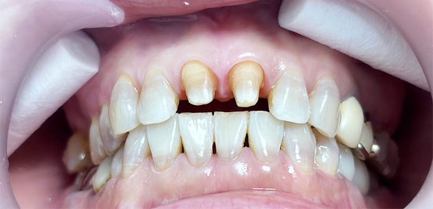 症例